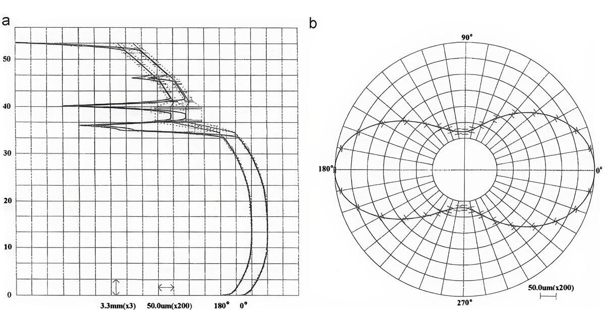 Grafico tecnico di usura pistone Vertex